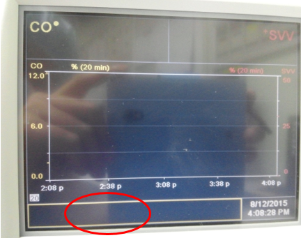 Vigileo — rear serial port