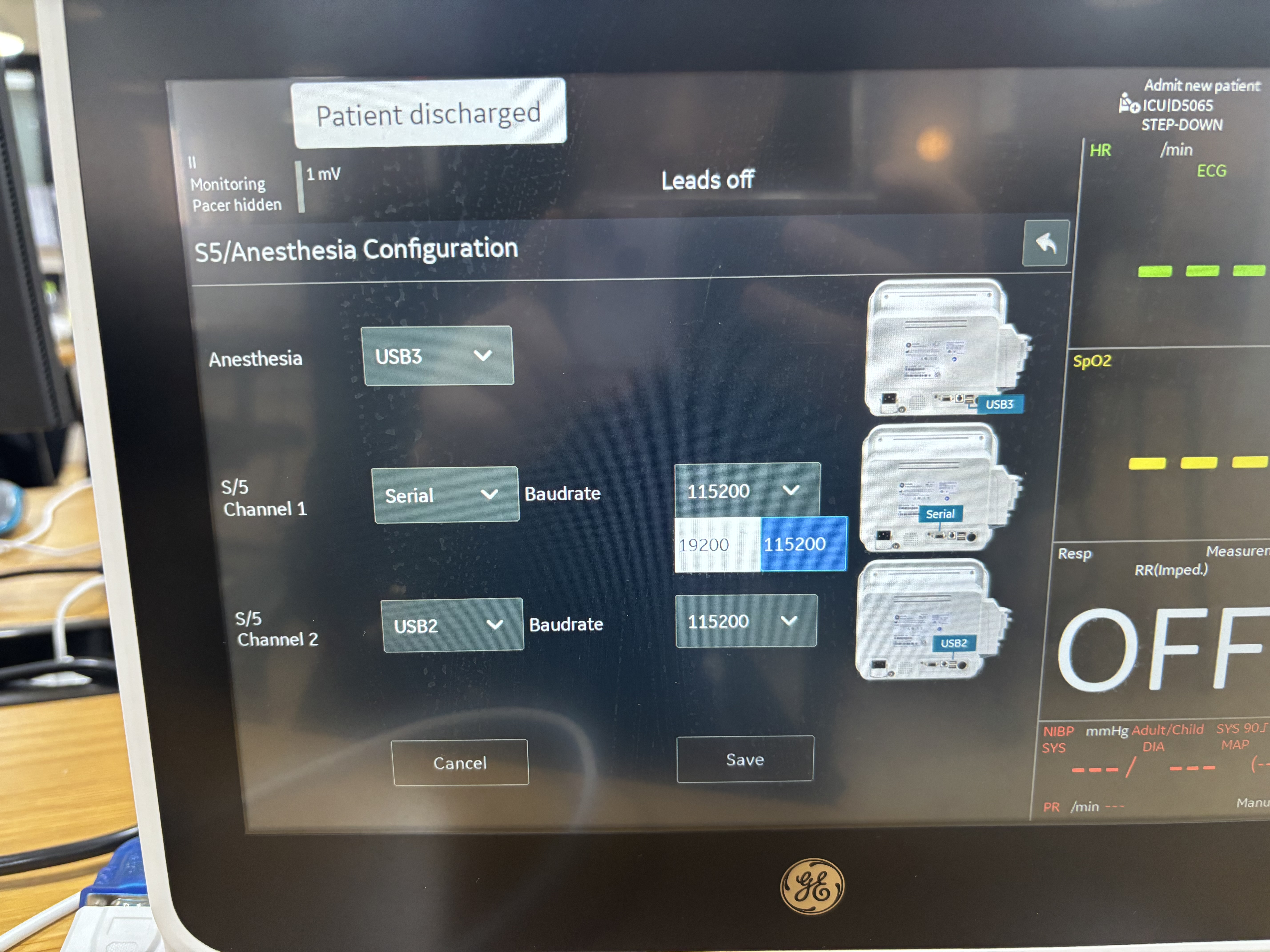 S5/Anesthesia Configuration — S/5 Channel 1 set to Serial, Baudrate 19200